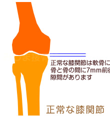 正常な膝関節